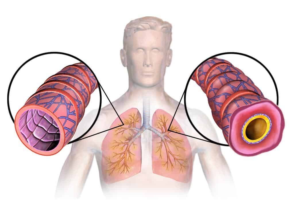 Чому не можна антигістамінні при бронхіальній астмі?