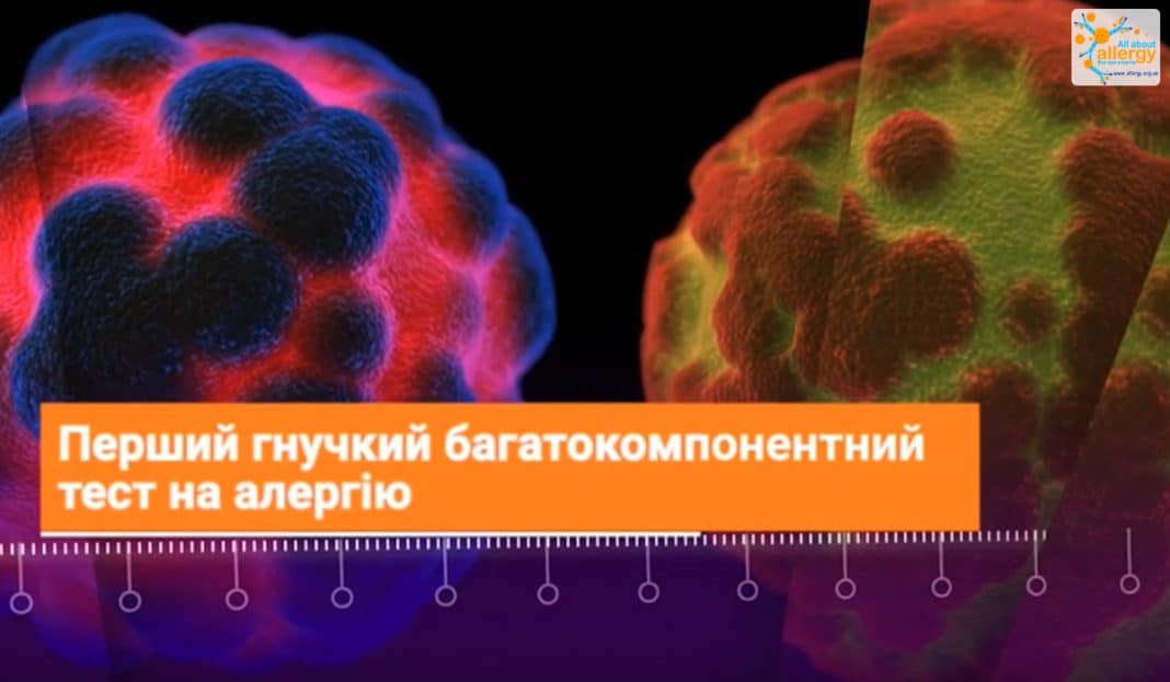 ALEX2: найінноваційніший метод діагностики алергії тепер доступний і в ...