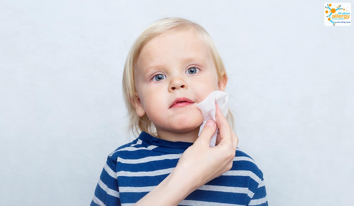 Может ли быть у ребенка аллергия на влажные салфетки thumbnail