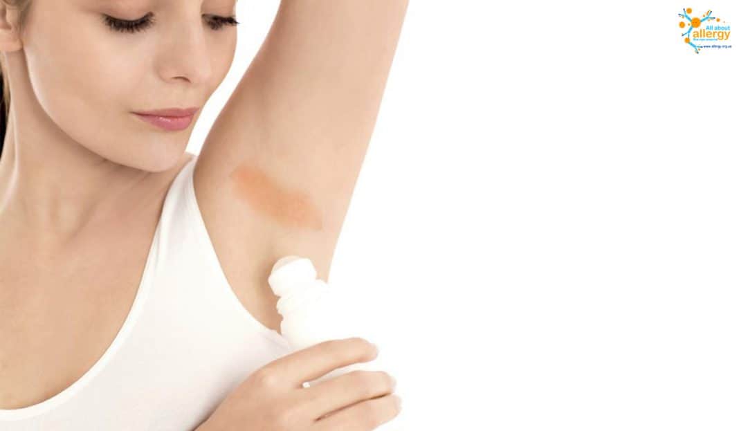 Аллергия на дезодорант определить и избавиться возможно Все про аллергию