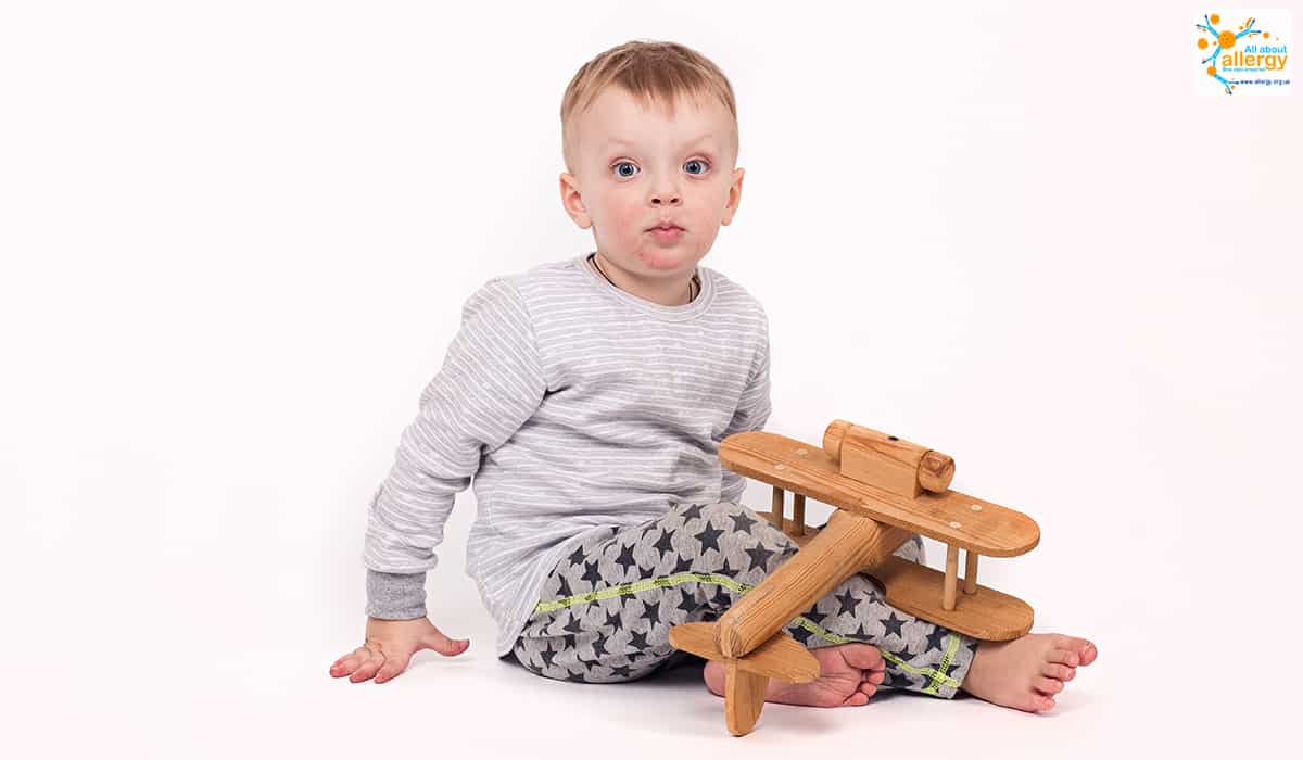 Проявления пищевой аллергии у ребенка