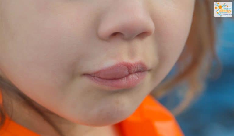 Аллергия на малых половых губах фото